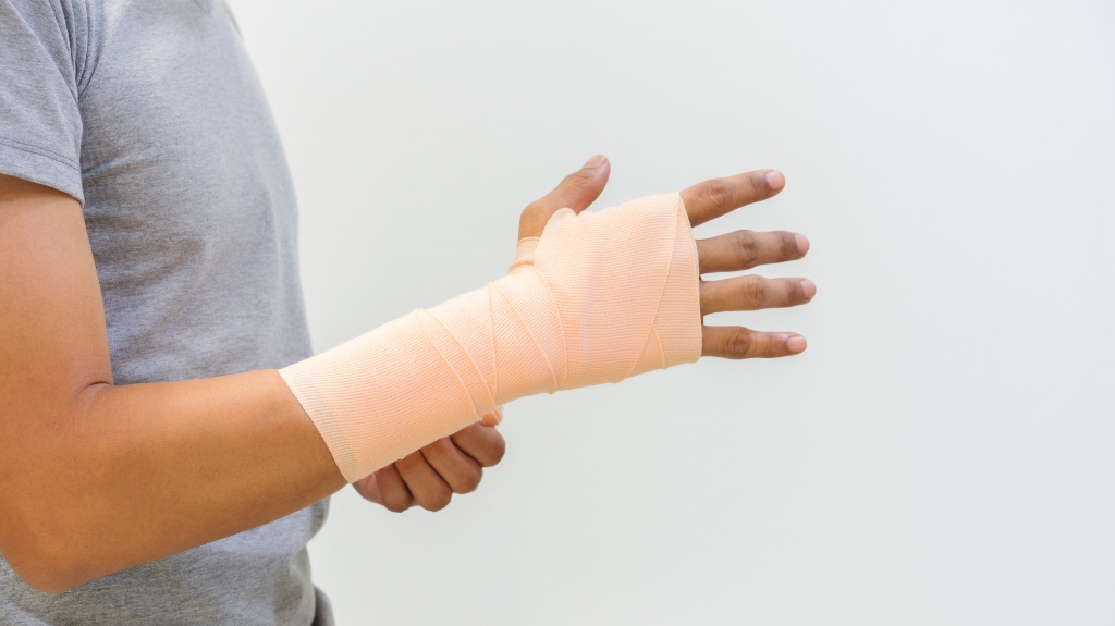 arm in a cast after injury