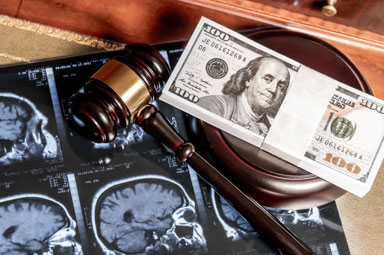 Brain Injury Law: Gavel, Money, Brain Scan