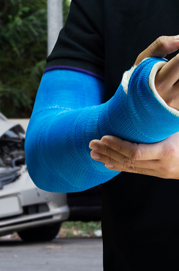 Arm Injury After Car Accident: Legal Claim